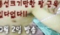 KBS韓国整形取材５