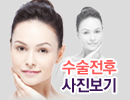 수술전후